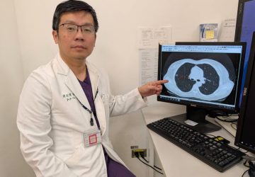 不抽菸也有風險　恩主公醫院示警肺癌家族史關鍵