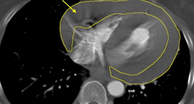 突發休克命懸一線　土城長庚醫療團隊72小時接力搶命成功